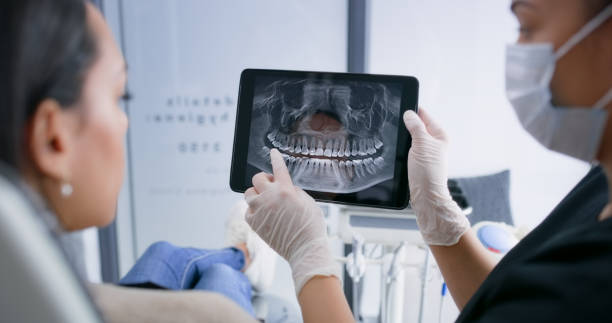 Licensed Tooth Extraction service in Port Neches, TX - Smile Center Dentistry